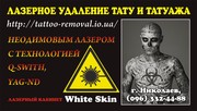 Лазерное удаление tattoo и перманентного tattooажа Николаев